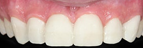 Island Heights dental images