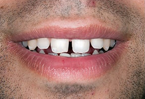 Toms River dental images