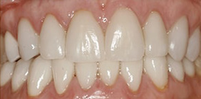 dental images 08753
