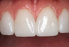 Island Heights dental images