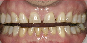 Toms River dental images